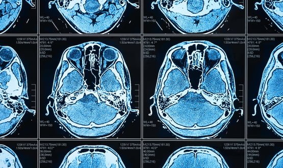 Hexarad radiology software cuts diagnostic wait times at North West Anglia