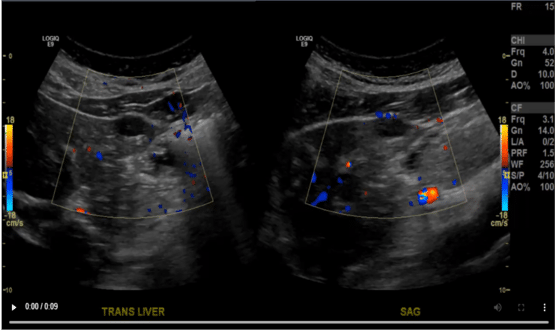 PACS Scan